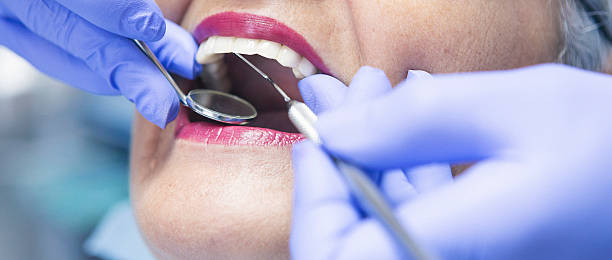 Best Emergency Tooth Extraction in Berthoud, CO